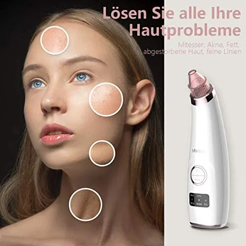 Mosen super Porenreiniger | Mitesserentferner mit Wärmegenerator – Bild 3