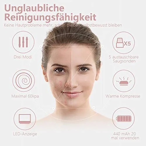 Mosen super Porenreiniger | Mitesserentferner mit Wärmegenerator – Bild 7