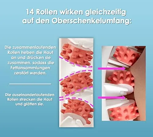TESMED Cellulite Massagegerät, Klinisch Nachgewiesene Wirksamkeit, Made in Italy, Anti Cellulite Massagegerät mit Rollen, welche die Haut heben, straffen und glätten. Patentiert – Bild 7
