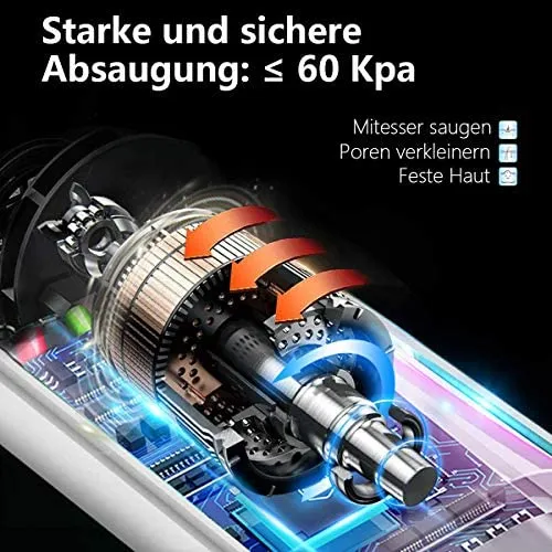 Mosen super Porenreiniger | Mitesserentferner mit Wärmegenerator – Bild 4