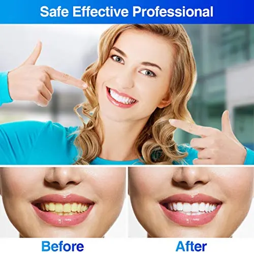 GLAMADOR Zahnaufhellung Set-Professionelles Zahnweiss Kit – Bild 7